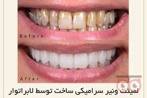 تخفیف ویژه خدمات دندانپزشکی تخفیف ویژه خدمات دندانپزشکی