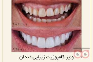 تخفیف ویژه خدمات دندانپزشکی تخفیف ویژه خدمات دندانپزشکی