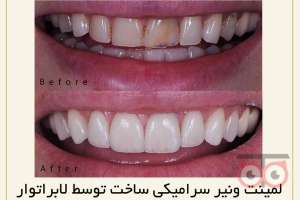 تخفیف ویژه خدمات دندانپزشکی تخفیف ویژه خدمات دندانپزشکی