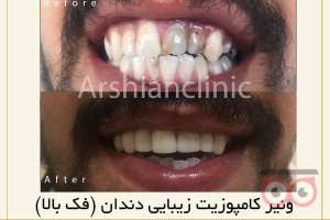 تخفیف ویژه خدمات دندانپزشکی تخفیف ویژه خدمات دندانپزشکی