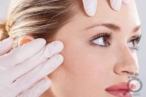 تخفیف درمان لک و جای جوش تخفیف درمان لک و جای جوش