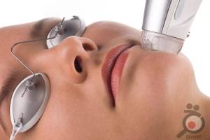 تخفیف درمان لک و جای جوش تخفیف درمان لک و جای جوش