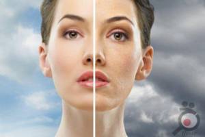 تخفیف خدمات زیبایی و بهداشتی پوست تخفیف خدمات زیبایی و بهداشتی پوست