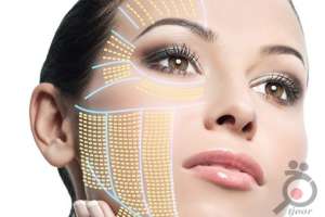 تخفیف ویژه کلینیک دکتر میرزایی تخفیف ویژه کلینیک دکتر میرزایی