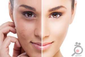 تخفیف ویژه کلینیک دکتر میرزایی تخفیف ویژه کلینیک دکتر میرزایی