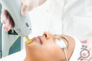 تخفیف خدمات لیزر تخفیف خدمات لیزر