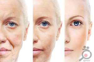 تخفیف ویژه فشیال و پاکسازی صورت تخفیف ویژه فشیال و پاکسازی صورت