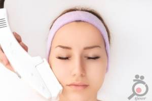 تخفیف ویژه لیزر موهای زائد تخفیف ویژه لیزر موهای زائد