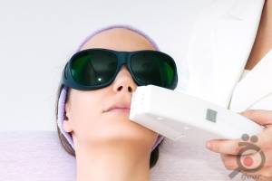 تخفیف ویژه لیزر موهای زائد تخفیف ویژه لیزر موهای زائد