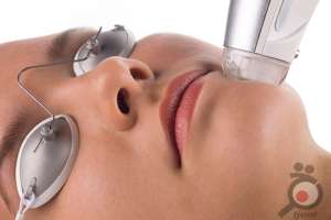 تخفیف میکرونیدلینگ تخفیف میکرونیدلینگ