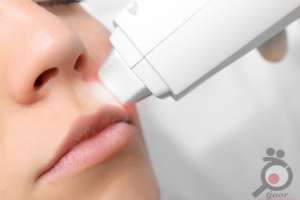 تخفیف ویژه لیزر موهای زائد تخفیف ویژه لیزر موهای زائد