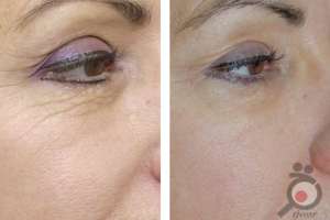 تخفیف ویژه پلاسما جت تخفیف ویژه پلاسما جت