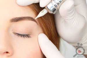 تخفیف تابستانی میکروپیگمنتیشن تخفیف تابستانی میکروپیگمنتیشن