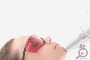 تخفیف جشنواره لیزر موهای زائد تخفیف جشنواره لیزر موهای زائد