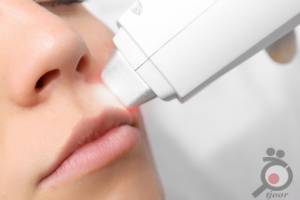 تخفیف جشنواره لیزر موهای زائد تخفیف جشنواره لیزر موهای زائد