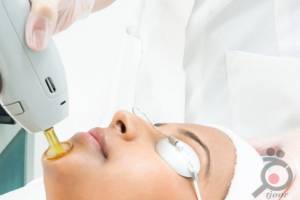 تخفیف جشنواره لیزر موهای زائد تخفیف جشنواره لیزر موهای زائد