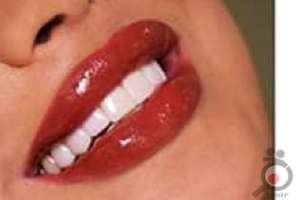 طرح تخفیفات دندانپزشکی از تولد تا تولد به مناسبت دهه کرامت طرح تخفیفات دندانپزشکی از تولد تا تولد به مناسبت دهه کرامت