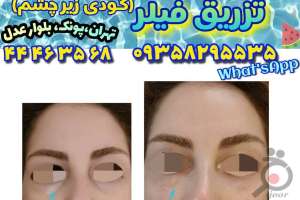 جشنواره تخفیفات تابستانی بر روی فیلر جشنواره تخفیفات تابستانی بر روی فیلر