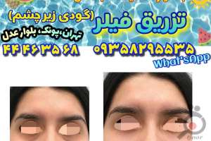 جشنواره تخفیفات تابستانی بر روی فیلر جشنواره تخفیفات تابستانی بر روی فیلر