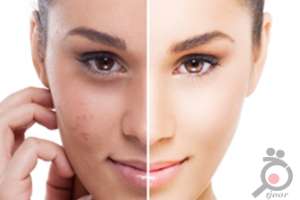 تخفیف خدمات تخصصی زیبایی پوست تخفیف خدمات تخصصی زیبایی پوست