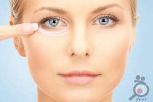 تخفیف ویژه پاکسازی بوسیله اسکوم تراپی تخفیف ویژه پاکسازی بوسیله اسکوم تراپی