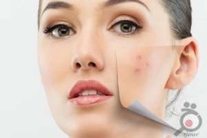 تخفیف خدمات پاکسازی صورت برای بانوان تخفیف خدمات پاکسازی صورت برای بانوان