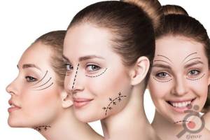 تخفیف ویژه رفع چروک دور چشم و جوانسازی دور چشم تخفیف ویژه رفع چروک دور چشم و جوانسازی دور چشم