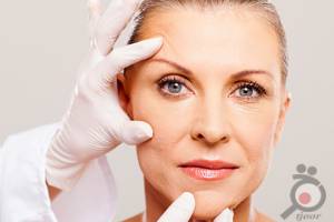 تخفیف ویژه رفع افتادگی پلک بدون عمل جراحی تخفیف ویژه رفع افتادگی پلک بدون عمل جراحی