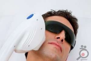 تخفیف ویژه خدمات لیزر موهای زائد تخفیف ویژه خدمات لیزر موهای زائد