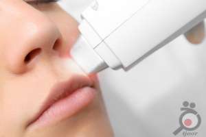 تخفیف ویژه خدمات لیزر موهای زائد تخفیف ویژه خدمات لیزر موهای زائد