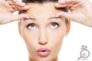 تخفیف ویژه عمل لیفت صورت تخفیف ویژه عمل لیفت صورت