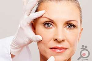 تخفیف ویژه عمل لیفت صورت تخفیف ویژه عمل لیفت صورت