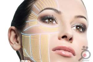 تخفیف ویژه عمل لیفت صورت تخفیف ویژه عمل لیفت صورت