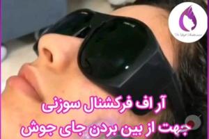 تخفیف کلینیک دکتر شاه حسینی رو از دست ندید تخفیف کلینیک دکتر شاه حسینی رو از دست ندید