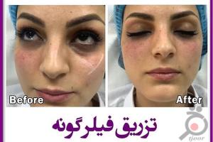 تخفیف کلینیک دکتر شاه حسینی رو از دست ندید تخفیف کلینیک دکتر شاه حسینی رو از دست ندید