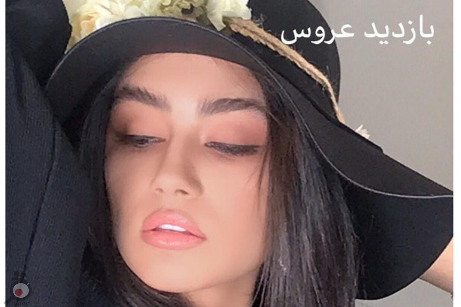 بازدید عروس به همراه تخفیف ویژه قرارداد بازدید عروس به همراه تخفیف ویژه قرارداد