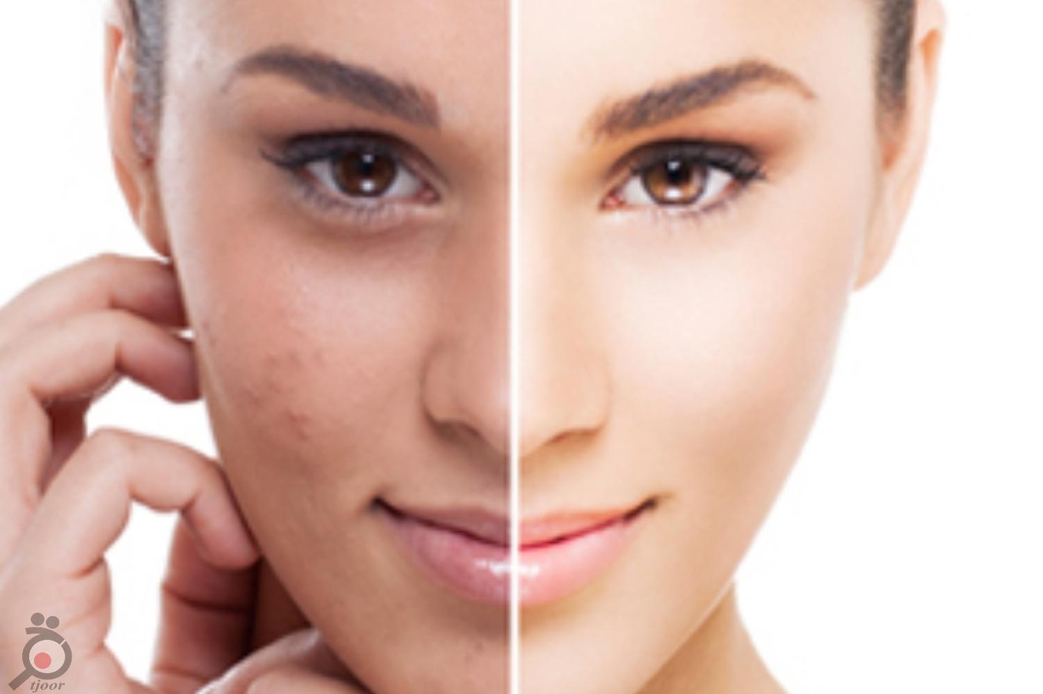 تخفیف ویژه بمناسبت پنجمین سالگرد کلینیک تخفیف ویژه بمناسبت پنجمین سالگرد کلینیک