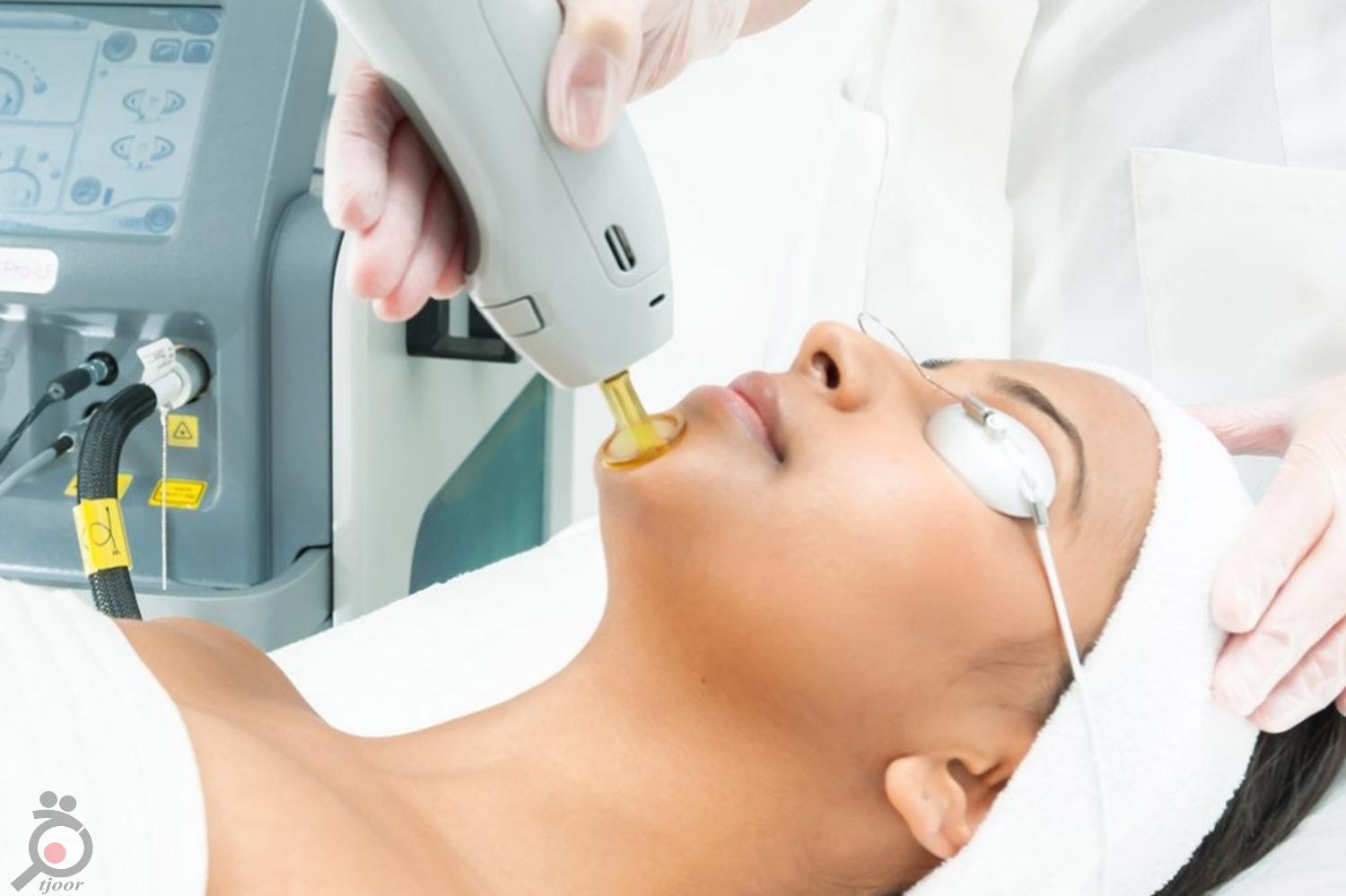 تخفیف ویژه لیزر بانوان تخفیف ویژه لیزر بانوان