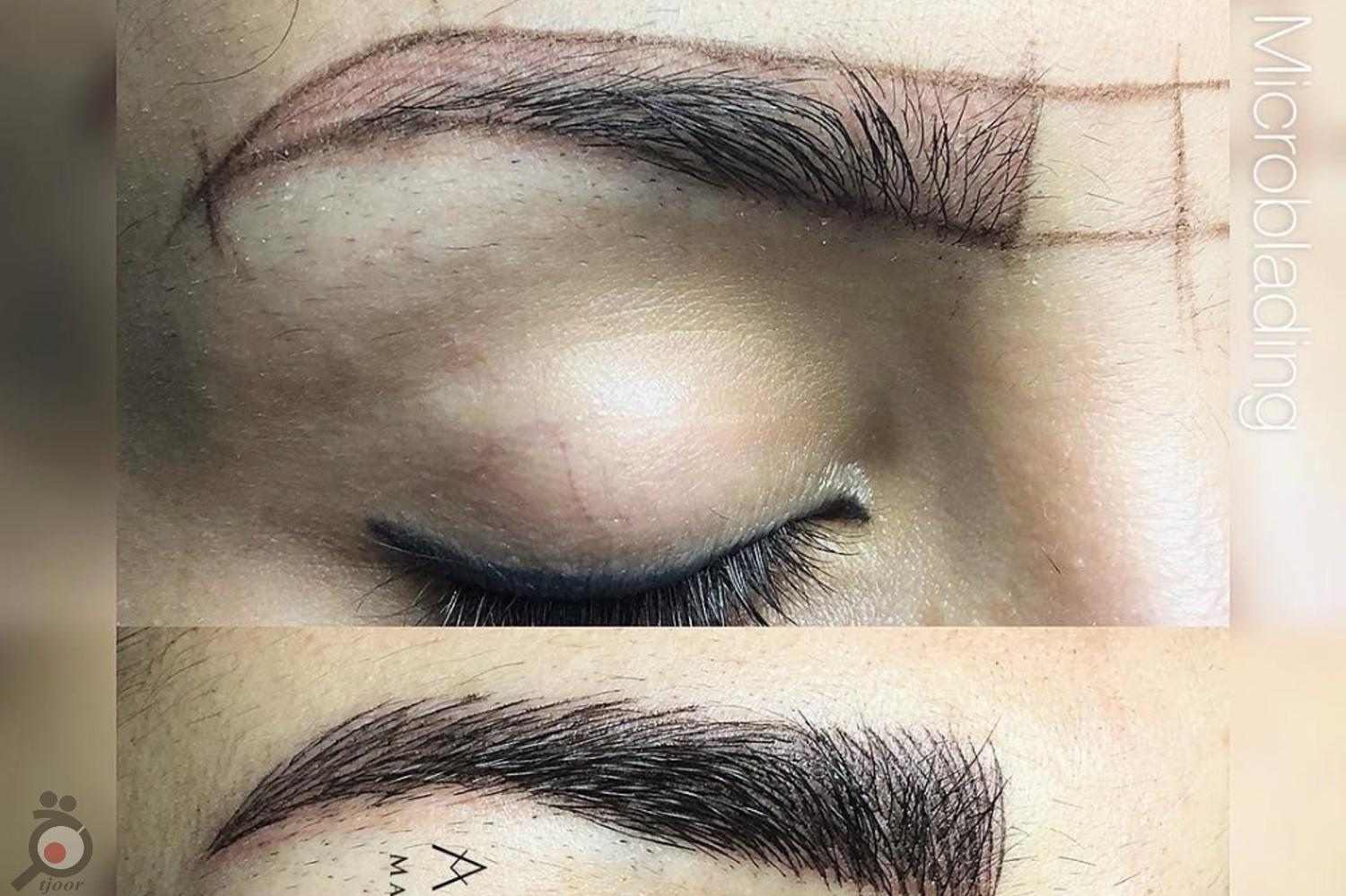 تخفیف آموزش میکروبلیدینگ و میکروپیگمنتیشن تخفیف آموزش میکروبلیدینگ و میکروپیگمنتیشن