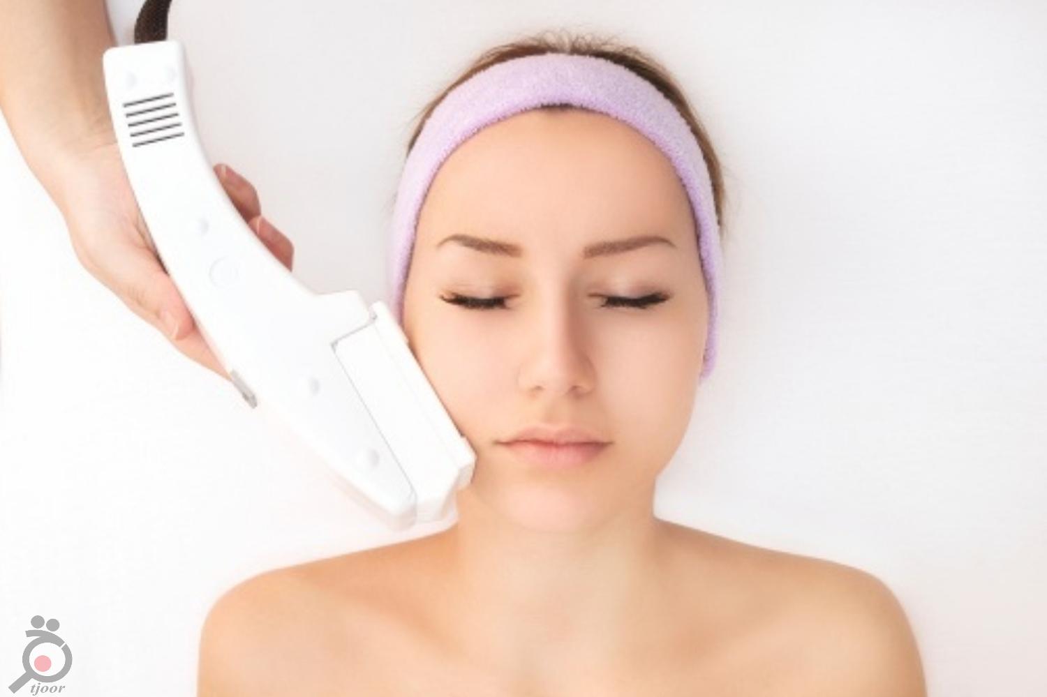 تخفیف ویژه لیزر تخفیف ویژه لیزر