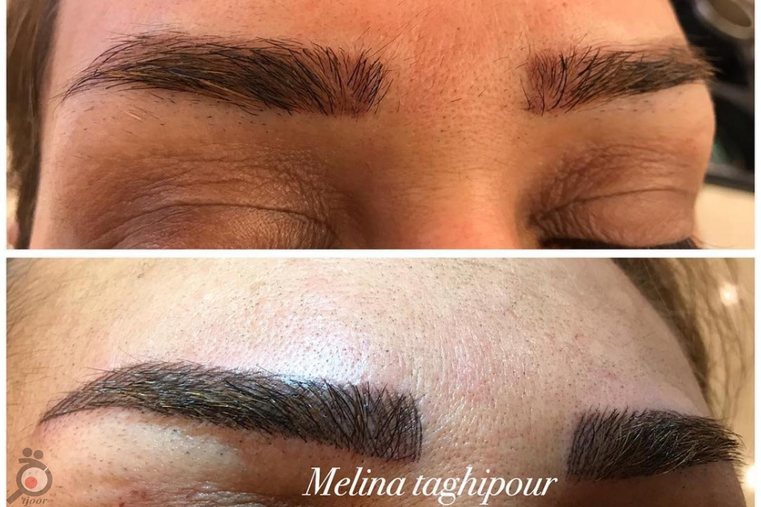 تخفیف ویژه خدمات ابرو تخفیف ویژه خدمات ابرو