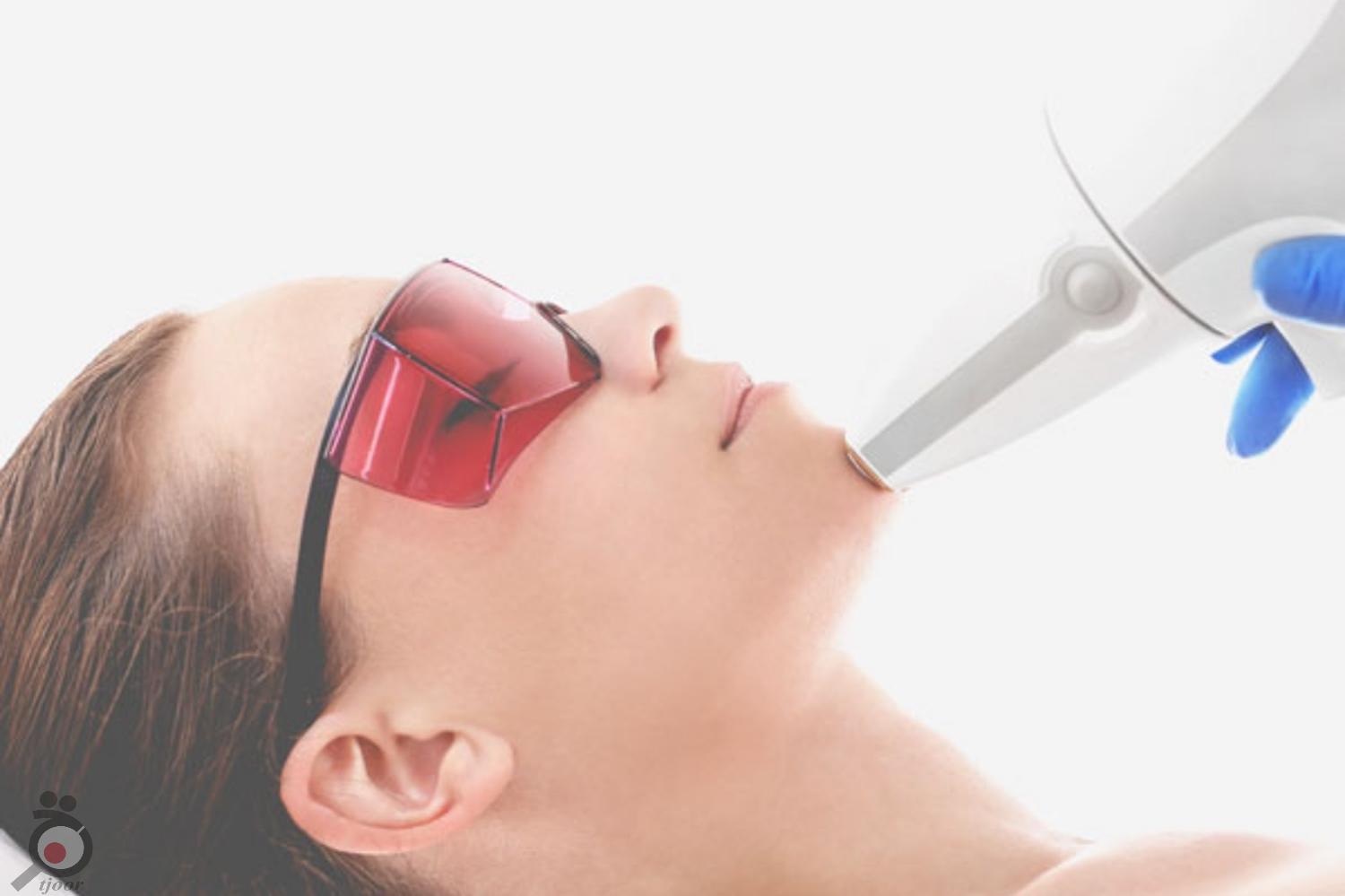 تخفیف ویژه لیزر تخفیف ویژه لیزر