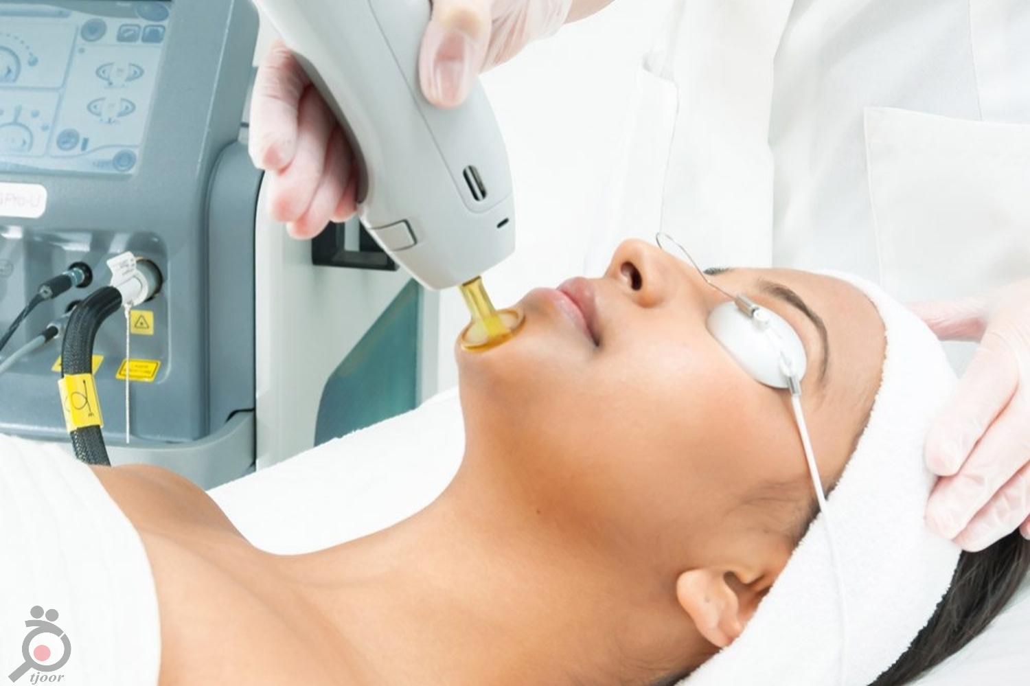 تخفیف ویژه لیزر تخفیف ویژه لیزر