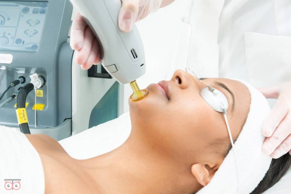 تخفیف ویژه لیزر تخفیف ویژه لیزر