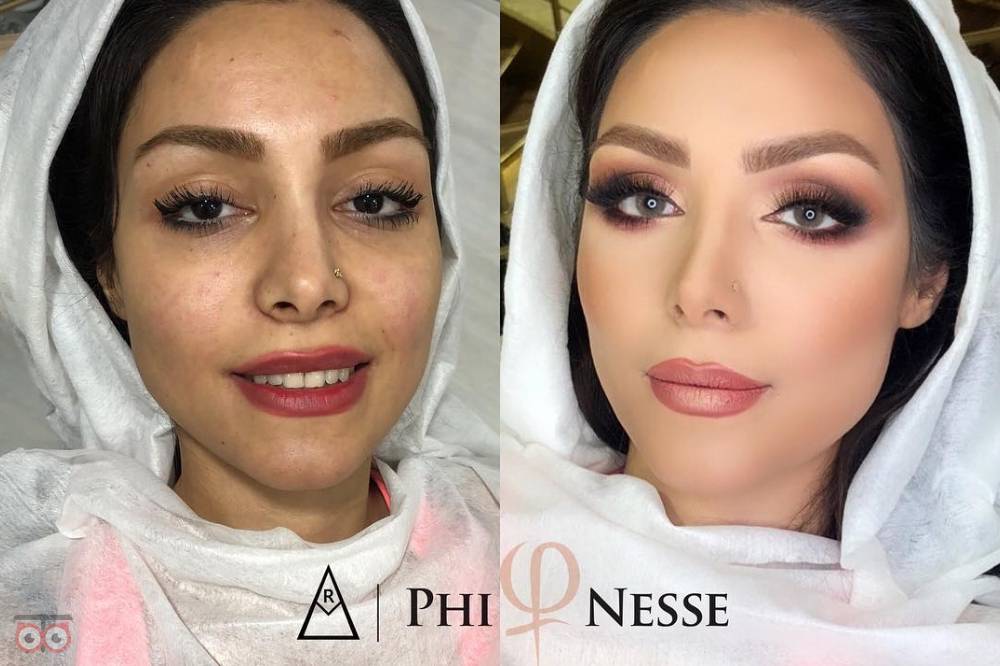 تخفیف ویژه قرارداد عروس تخفیف ویژه قرارداد عروس