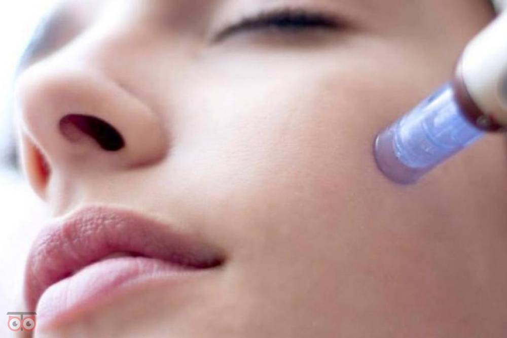 تخفیف ویژه میکرونیدلینگ تخفیف ویژه میکرونیدلینگ