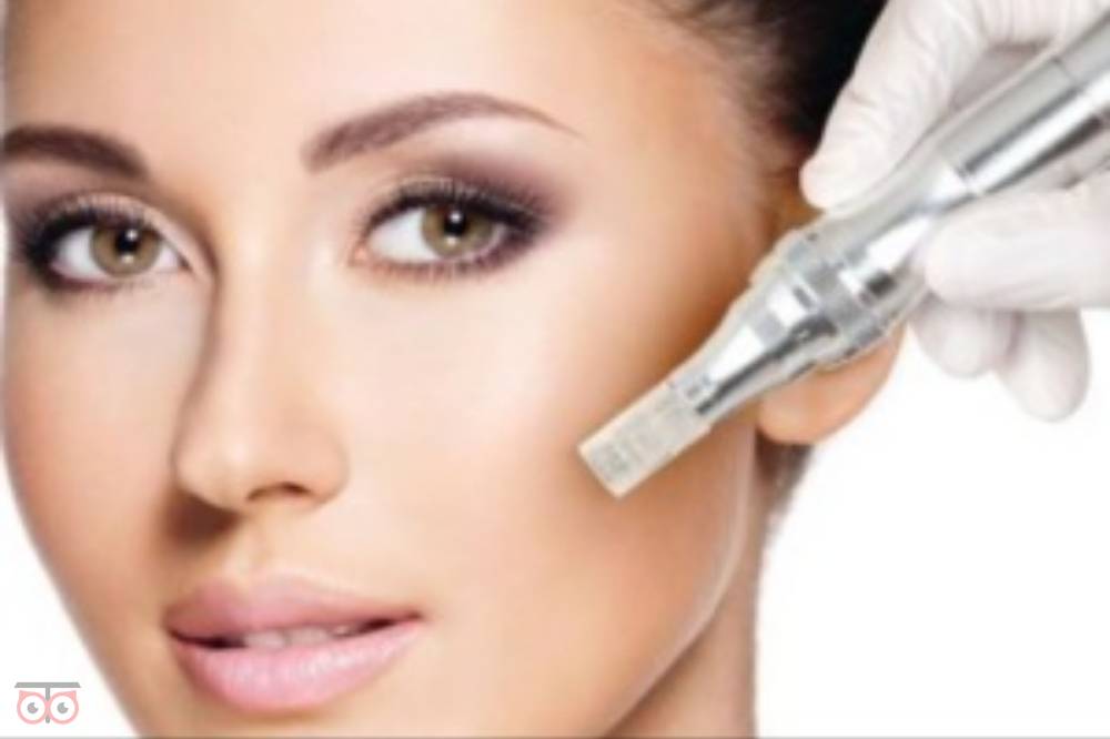 تخفیف ویژه میکرونیدلینگ تخفیف ویژه میکرونیدلینگ