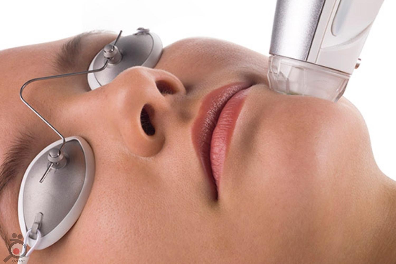 پکیج ویژه پاییزی آر اف+میکرودرم پکیج ویژه پاییزی آر اف+میکرودرم