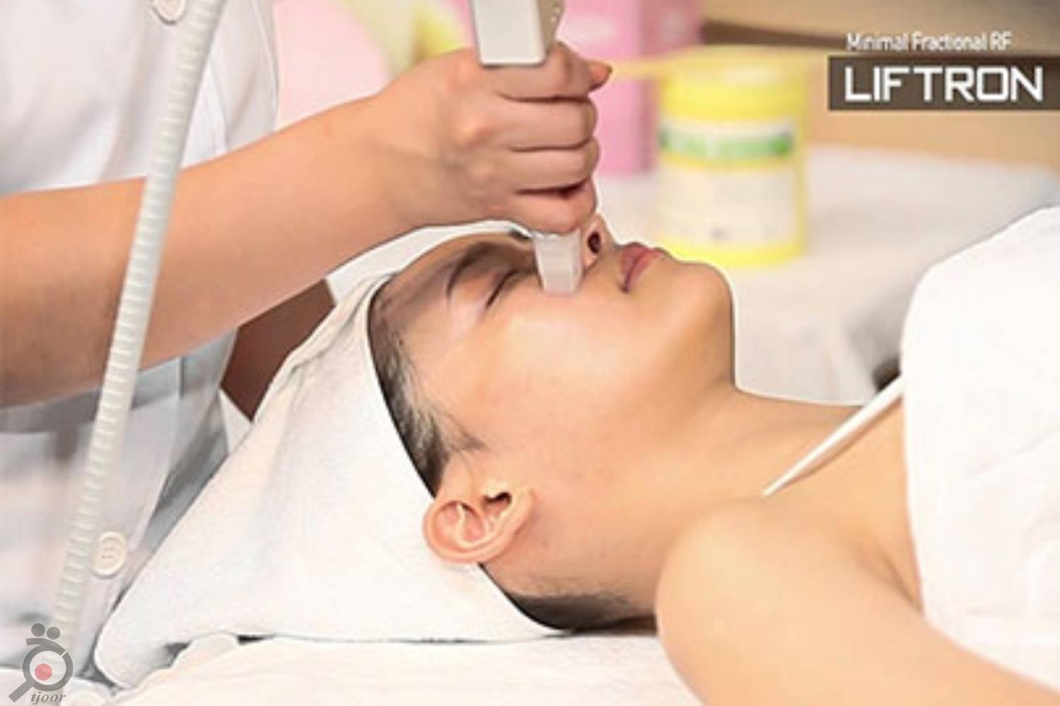 پکیج 3 جلسه ای آر اف صورت پکیج 3 جلسه ای آر اف صورت