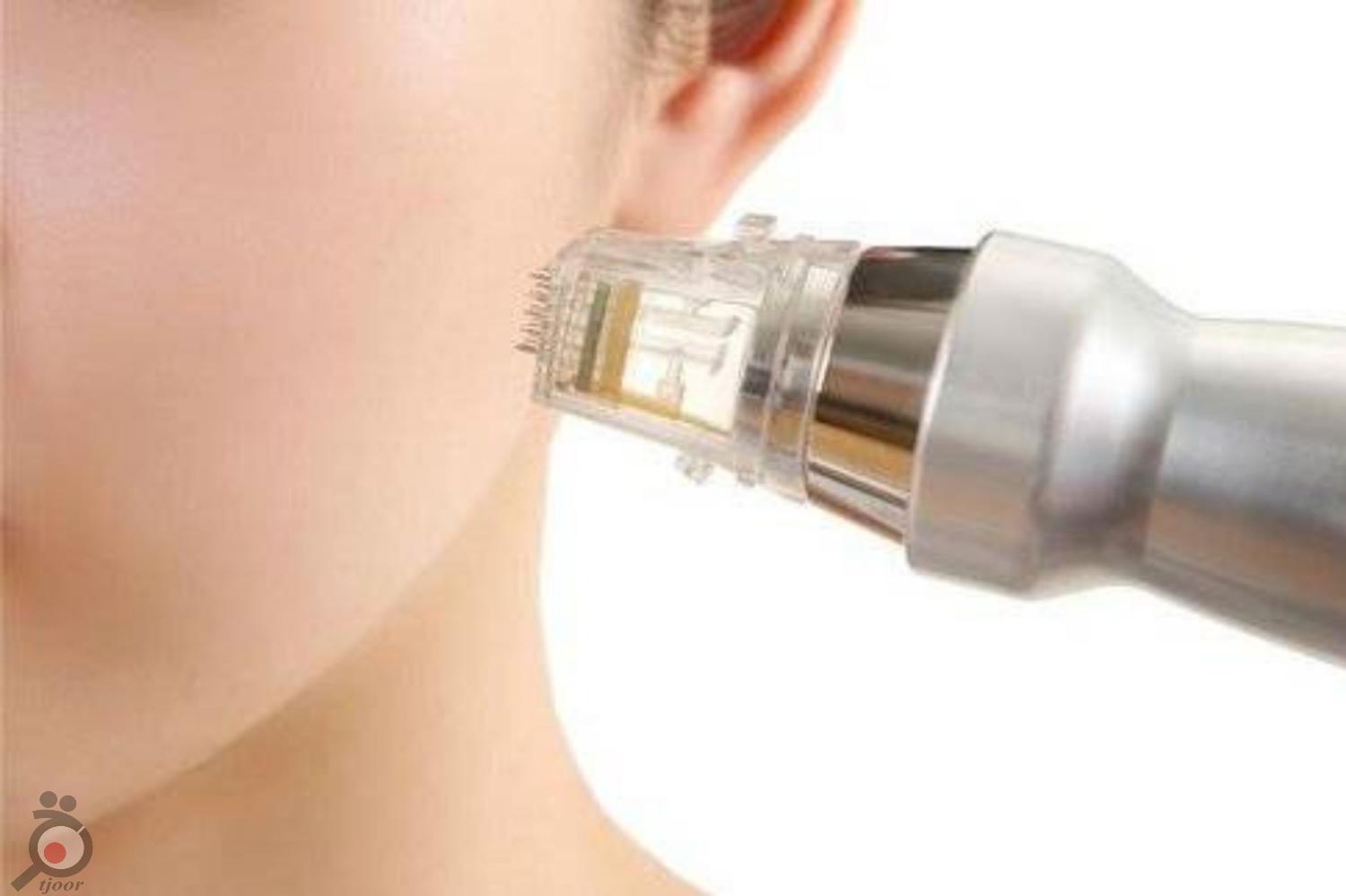 پکیج 3 جلسه ای آر اف صورت پکیج 3 جلسه ای آر اف صورت